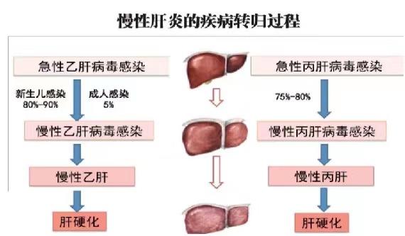 【健康科普】世界肝炎日——堅持早預(yù)防，加強檢測發(fā)現(xiàn)，規(guī)范抗病毒治療